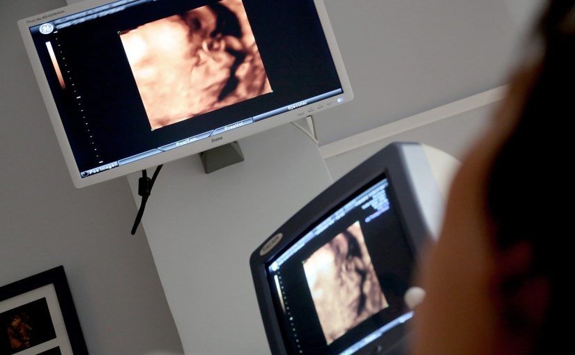 Pracownia RTG i USG: Kluczowe Aspekty Diagnostyki Obrazowej w Służbie Rehabilitacji